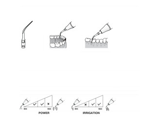 INSERT WOODPECKER P3 COMPATIBLE EMS-COXO - REF:730