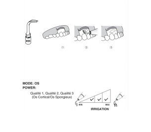 INSERT WOODPECKER US5 COMPATIBLE MECTRON-COXO - REF:721
